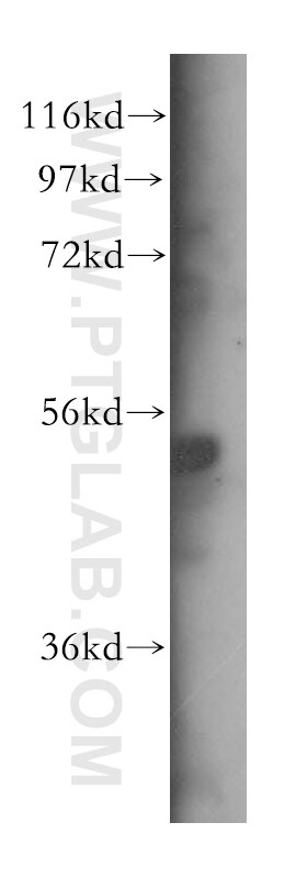 Western Blot (WB) analysis of HeLa cells using SDCCAG10 Polyclonal antibody (16502-1-AP)