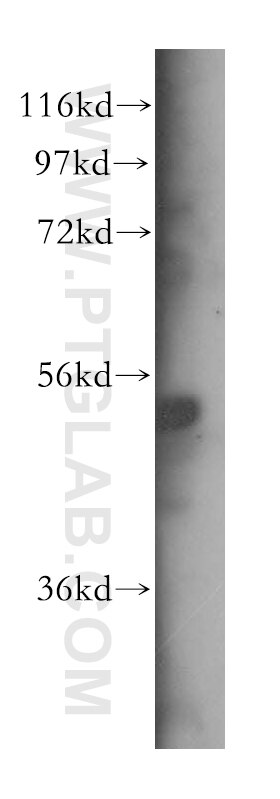 WB analysis of HeLa using 16502-1-AP