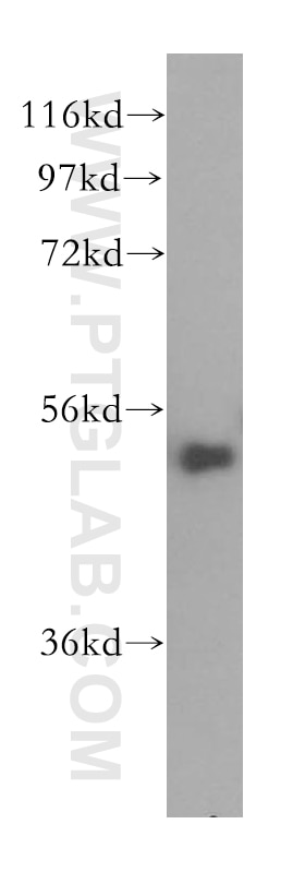 Western Blot (WB) analysis of HepG2 cells using SDCCAG10 Polyclonal antibody (16502-1-AP)