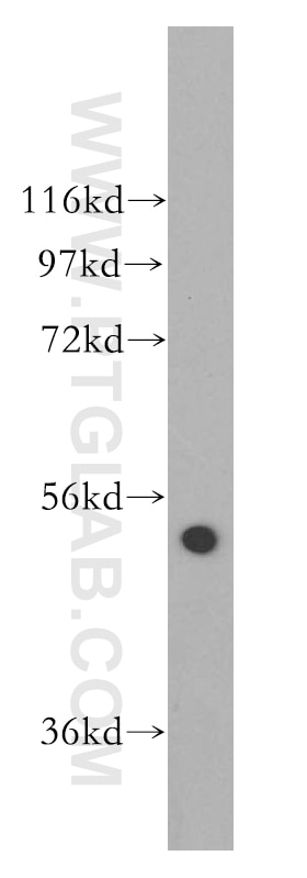 Western Blot (WB) analysis of human colon tissue using SDCCAG10 Polyclonal antibody (16502-1-AP)