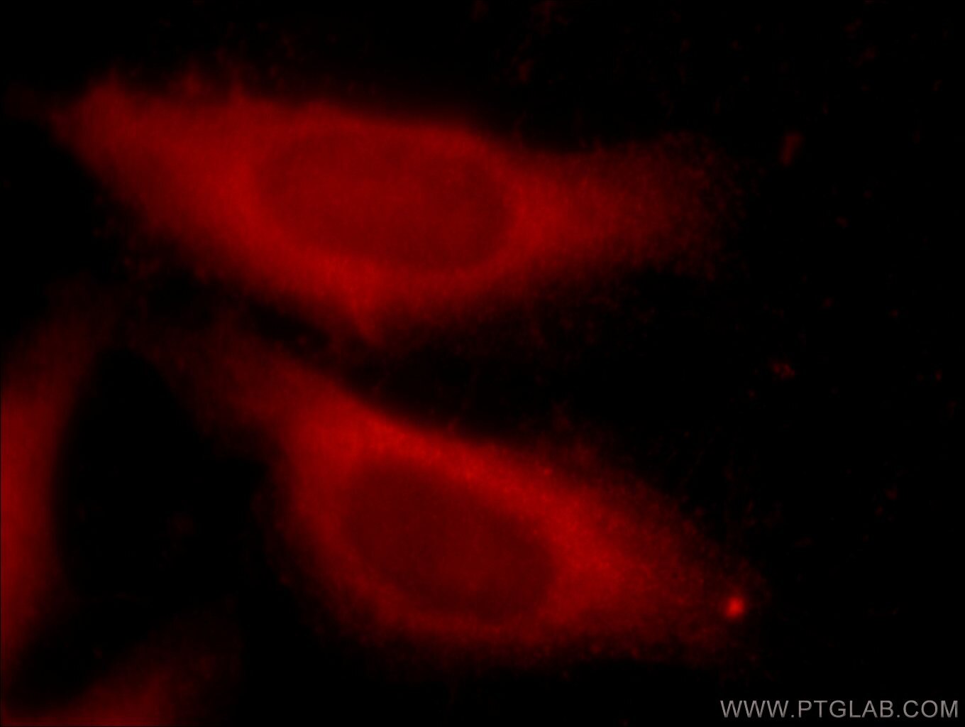 IF Staining of HepG2 using 15969-1-AP