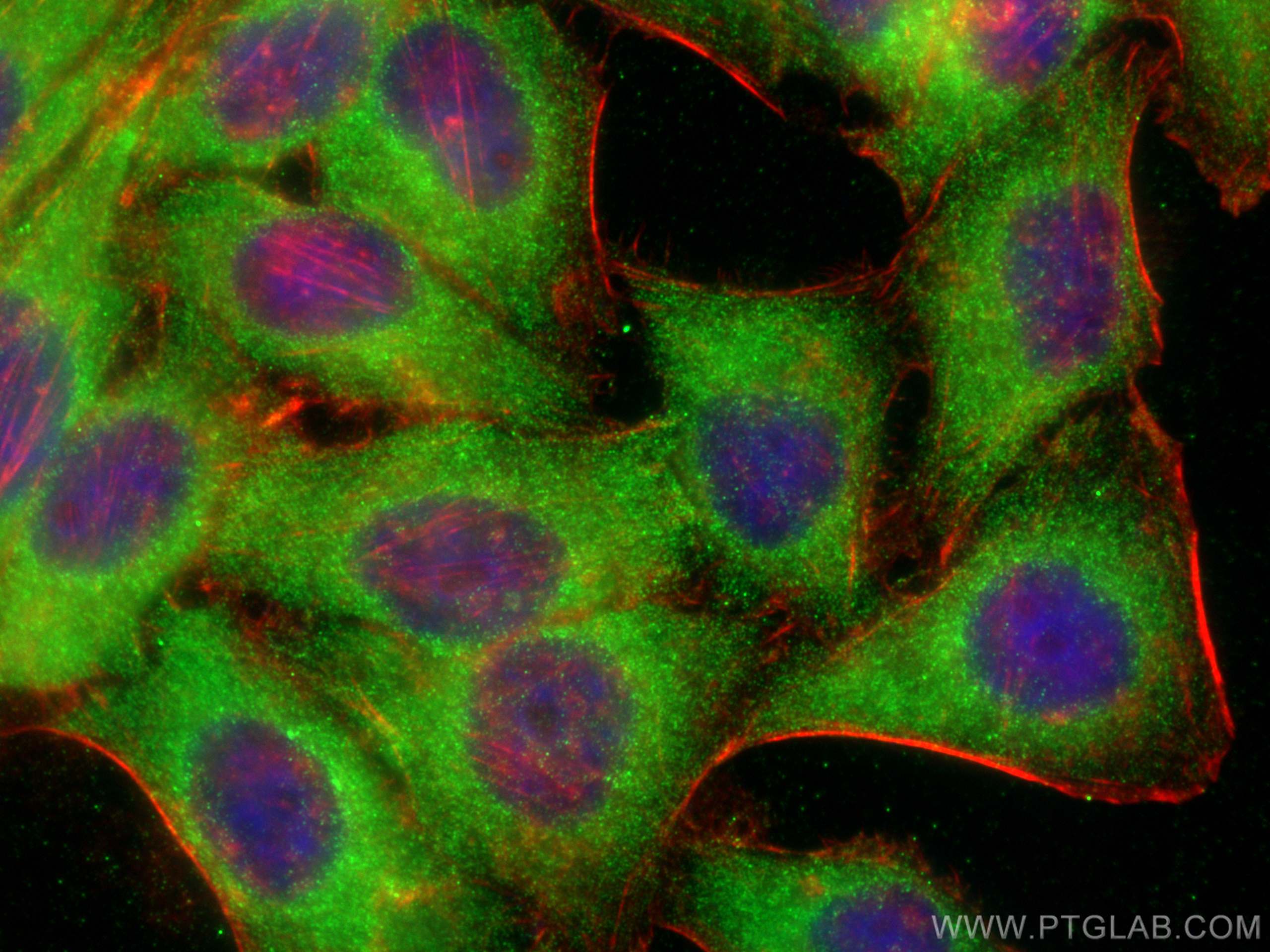 Immunofluorescence (IF) / fluorescent staining of HepG2 cells using SDCCAG3 Polyclonal antibody (15969-1-AP)