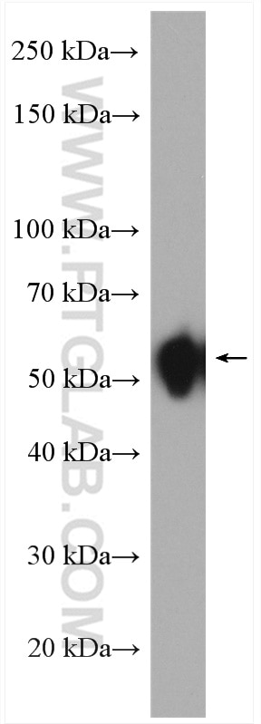 Western Blot (WB) analysis of HeLa cells using SDCCAG3 Polyclonal antibody (15969-1-AP)