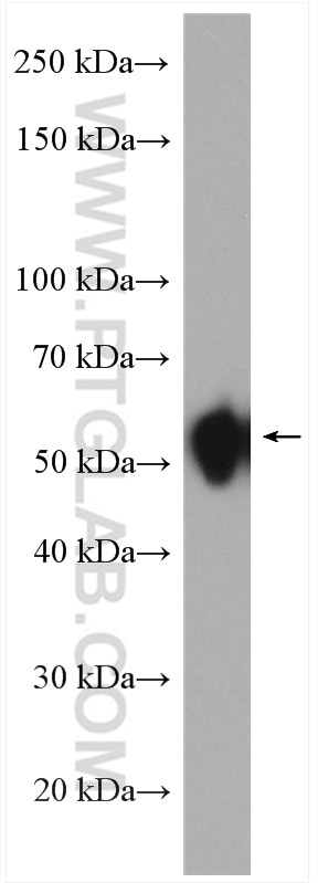 WB analysis of HeLa using 15969-1-AP