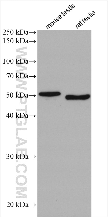 Western Blot (WB) analysis of various lysates using SDCCAG3 Polyclonal antibody (15969-1-AP)