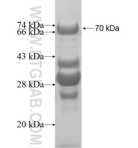 SDCCAG3 fusion protein Ag8745 SDS-PAGE
