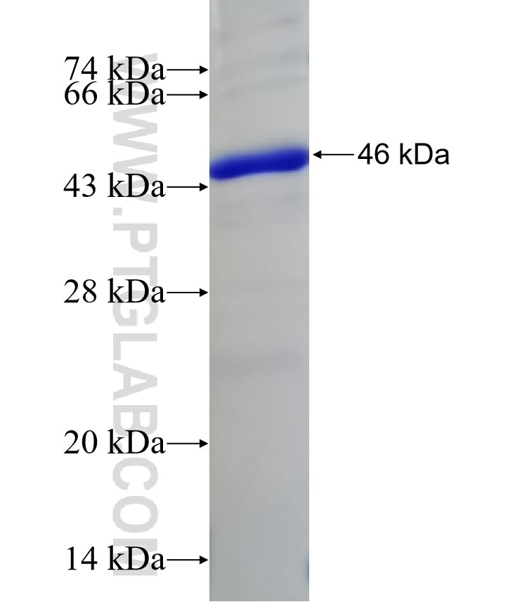 SDCCAG3 fusion protein Ag9093 SDS-PAGE