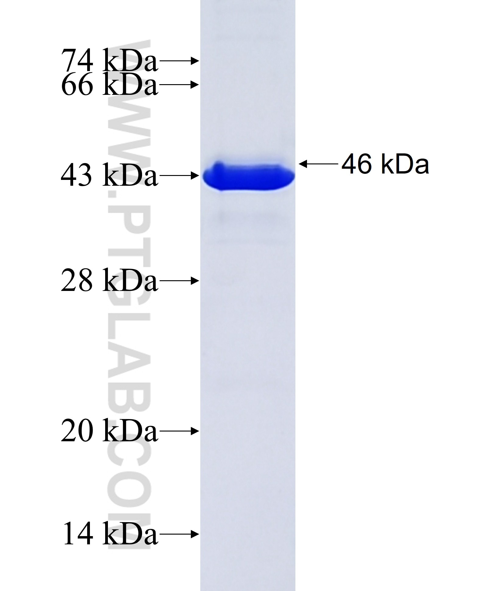SDCCAG3 fusion protein Ag9093 SDS-PAGE