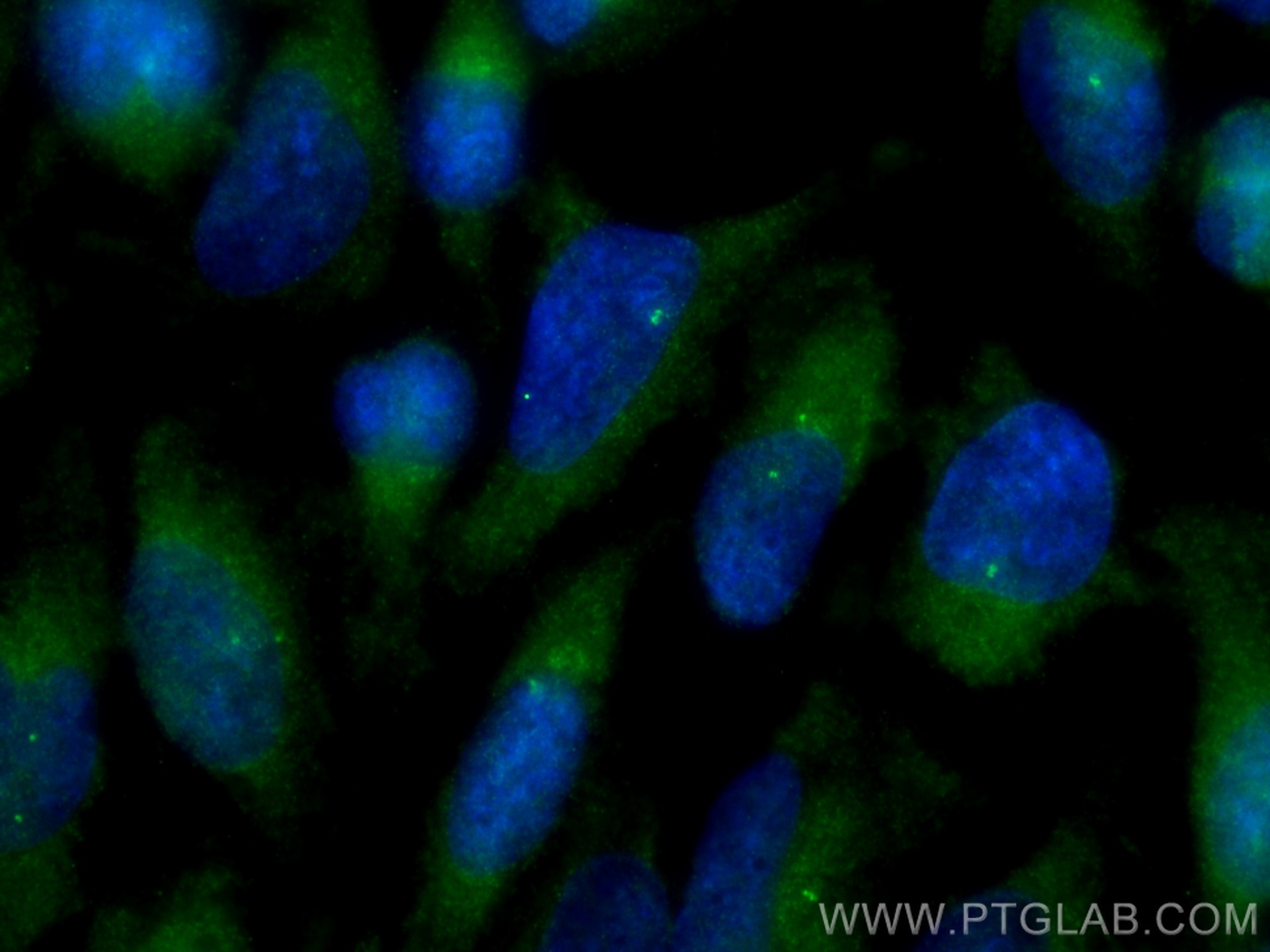 Immunofluorescence (IF) / fluorescent staining of HeLa cells using SDCCAG8 Polyclonal antibody (13471-1-AP)