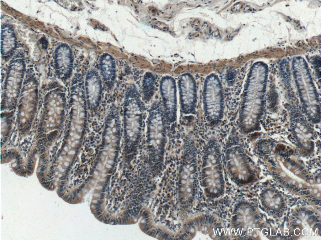 Immunohistochemistry (IHC) staining of human colon tissue using SDCCAG8 Polyclonal antibody (13471-1-AP)