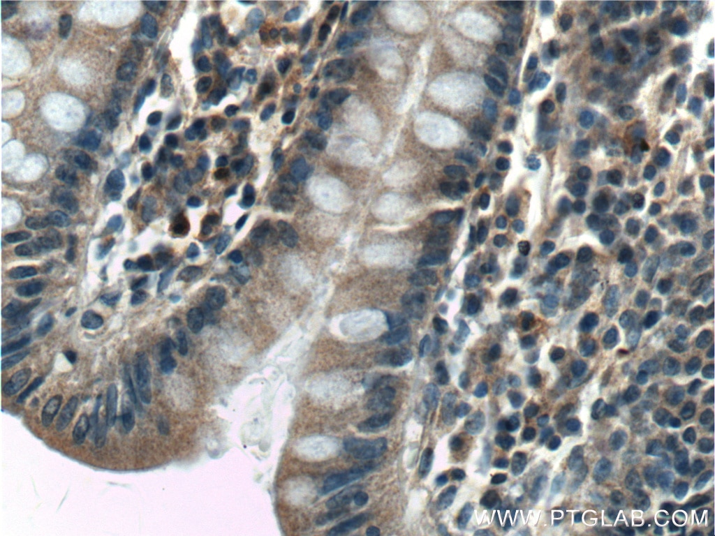 Immunohistochemistry (IHC) staining of human colon tissue using SDCCAG8 Polyclonal antibody (13471-1-AP)