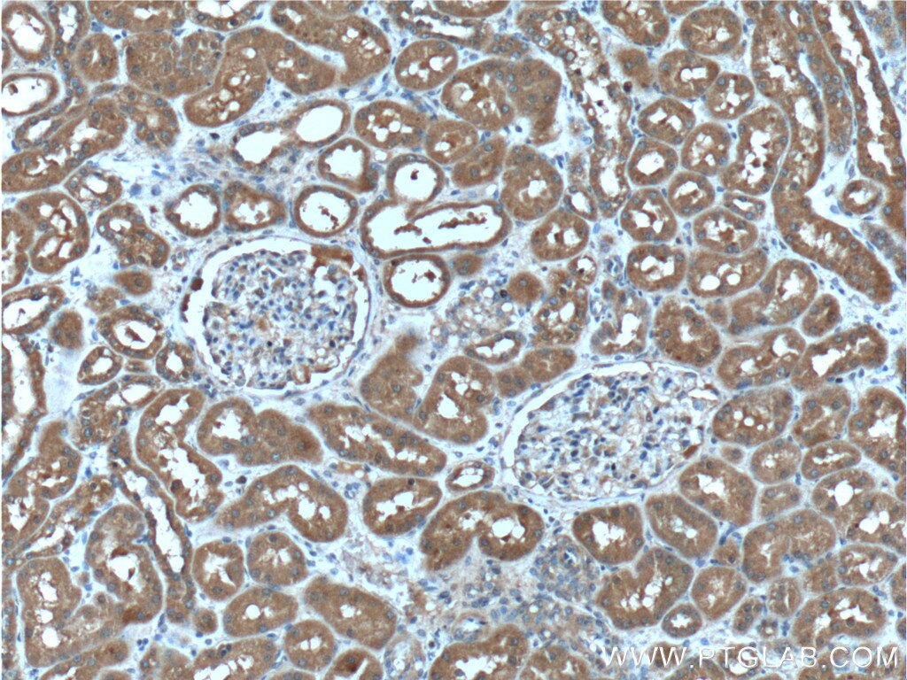 Immunohistochemistry (IHC) staining of human kidney tissue using SDCCAG8 Monoclonal antibody (66284-1-Ig)