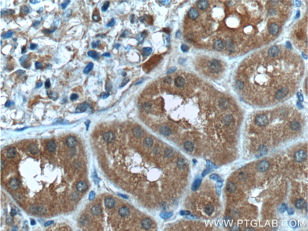 Immunohistochemistry (IHC) staining of human kidney tissue using SDCCAG8 Monoclonal antibody (66284-1-Ig)