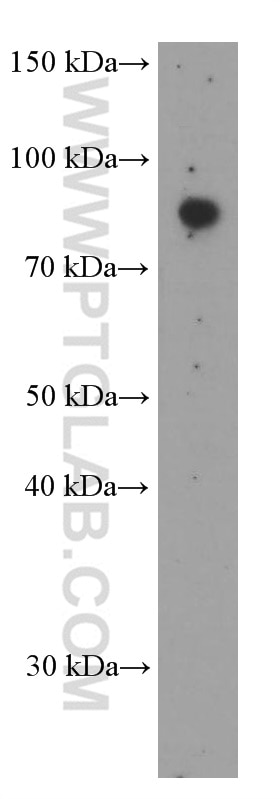 Western Blot (WB) analysis of HEK-293 cells using SDCCAG8 Monoclonal antibody (66284-1-Ig)