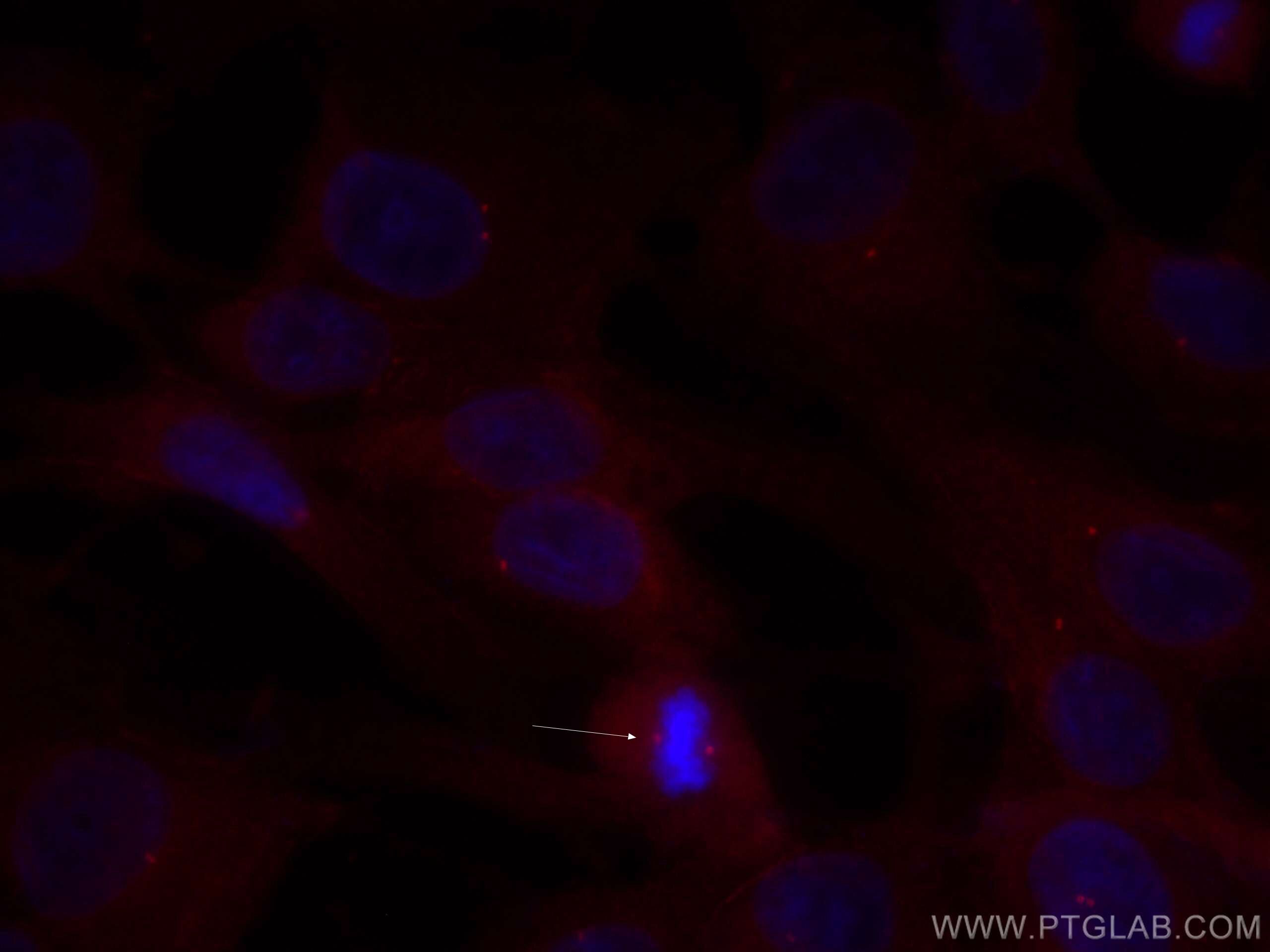 Immunofluorescence (IF) / fluorescent staining of MDCK cells using CoraLite®594-conjugated SDCCAG8 Polyclonal antibod (CL594-13471)