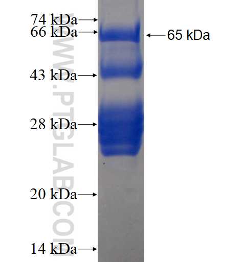 SDCCAG8 fusion protein Ag4264 SDS-PAGE