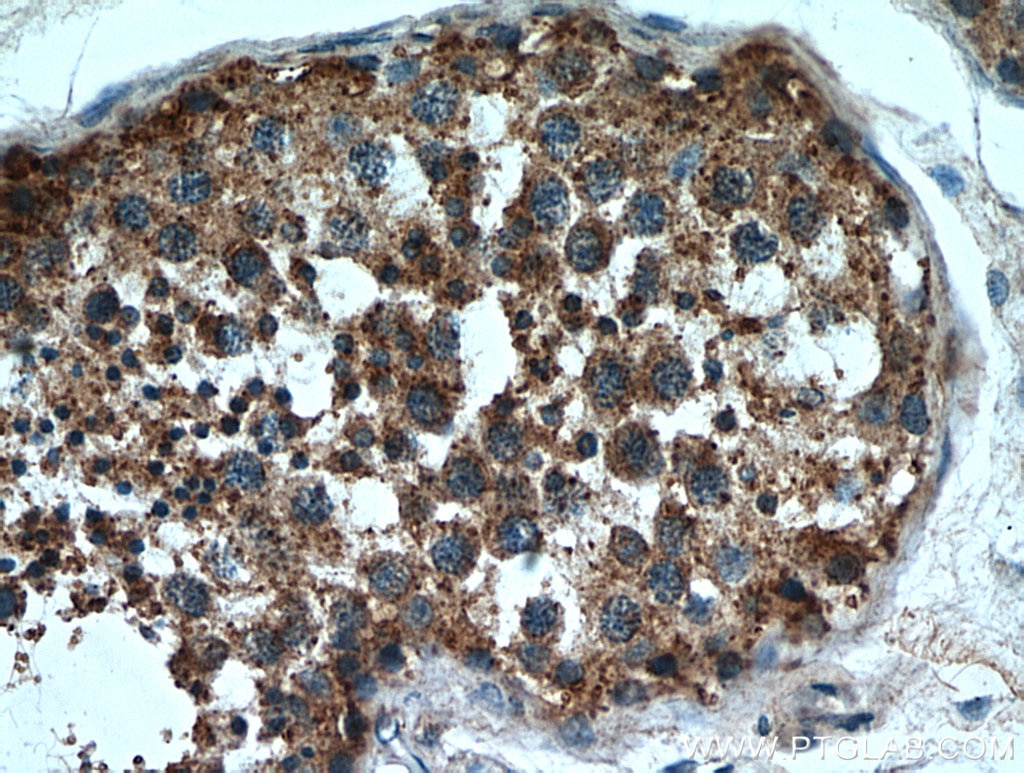 Immunohistochemistry (IHC) staining of human testis tissue using SDF2L1 Polyclonal antibody (20888-1-AP)