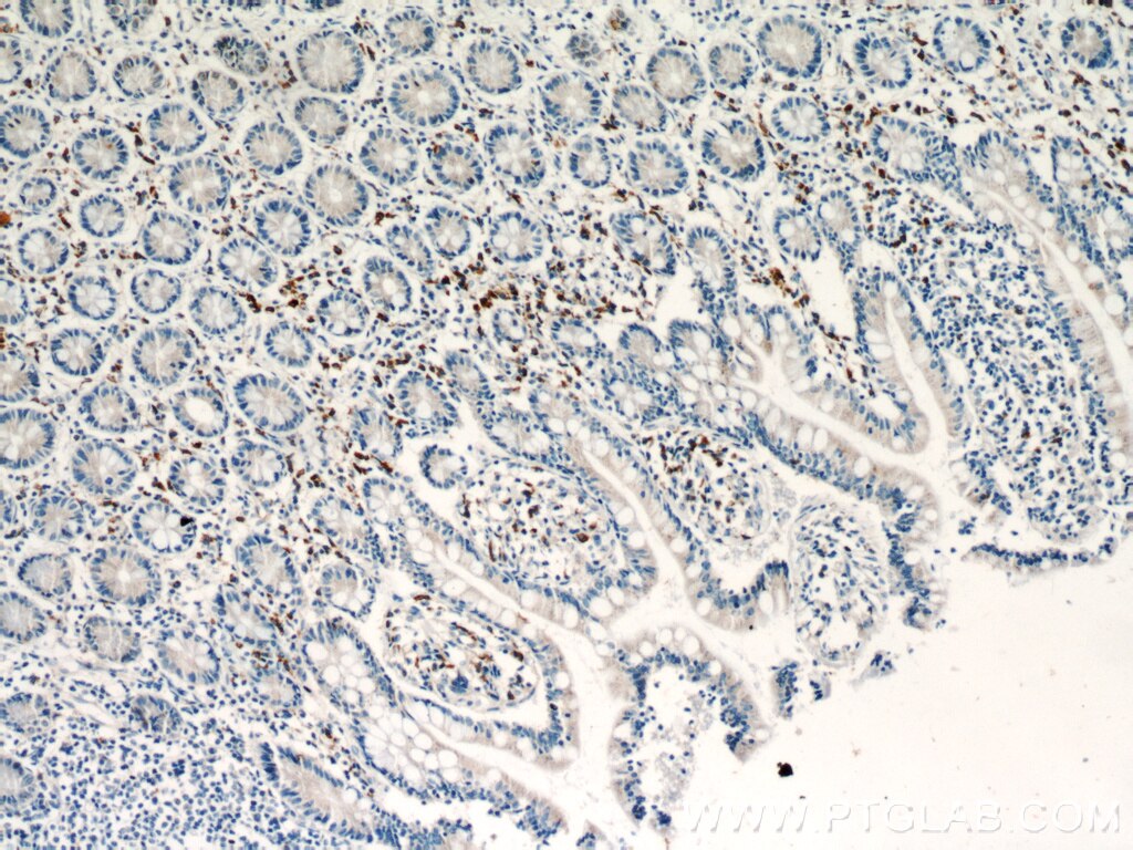 IHC staining of human small intestine using 20888-1-AP