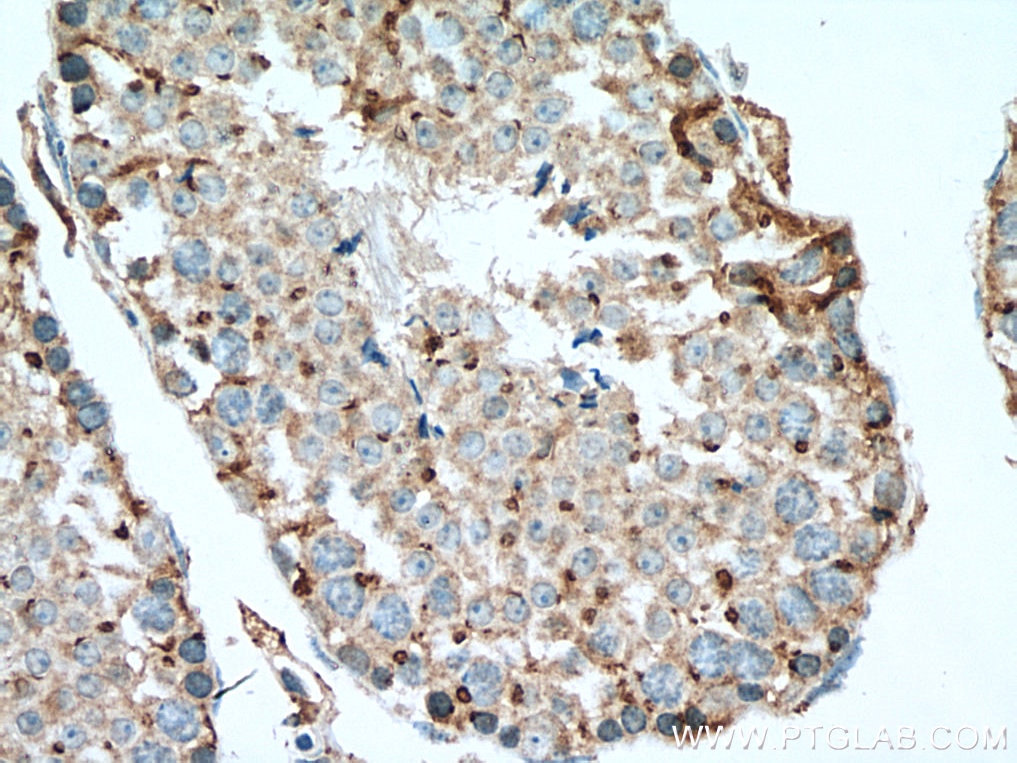 Immunohistochemistry (IHC) staining of mouse testis tissue using SDF4 Polyclonal antibody (10517-1-AP)