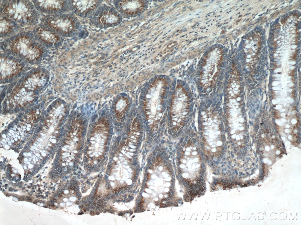 Immunohistochemistry (IHC) staining of human colon tissue using SDF4 Polyclonal antibody (10517-1-AP)