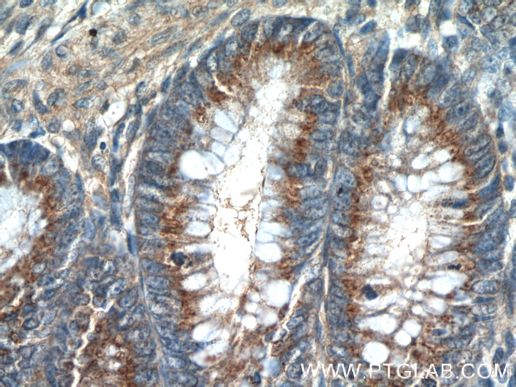 IHC staining of human colon using 10517-1-AP