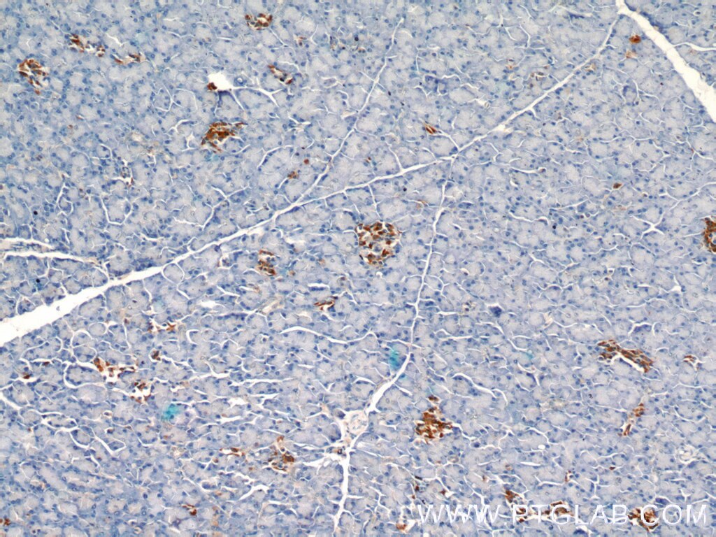 Immunohistochemistry (IHC) staining of human pancreas tissue using SDF4 Polyclonal antibody (10517-1-AP)