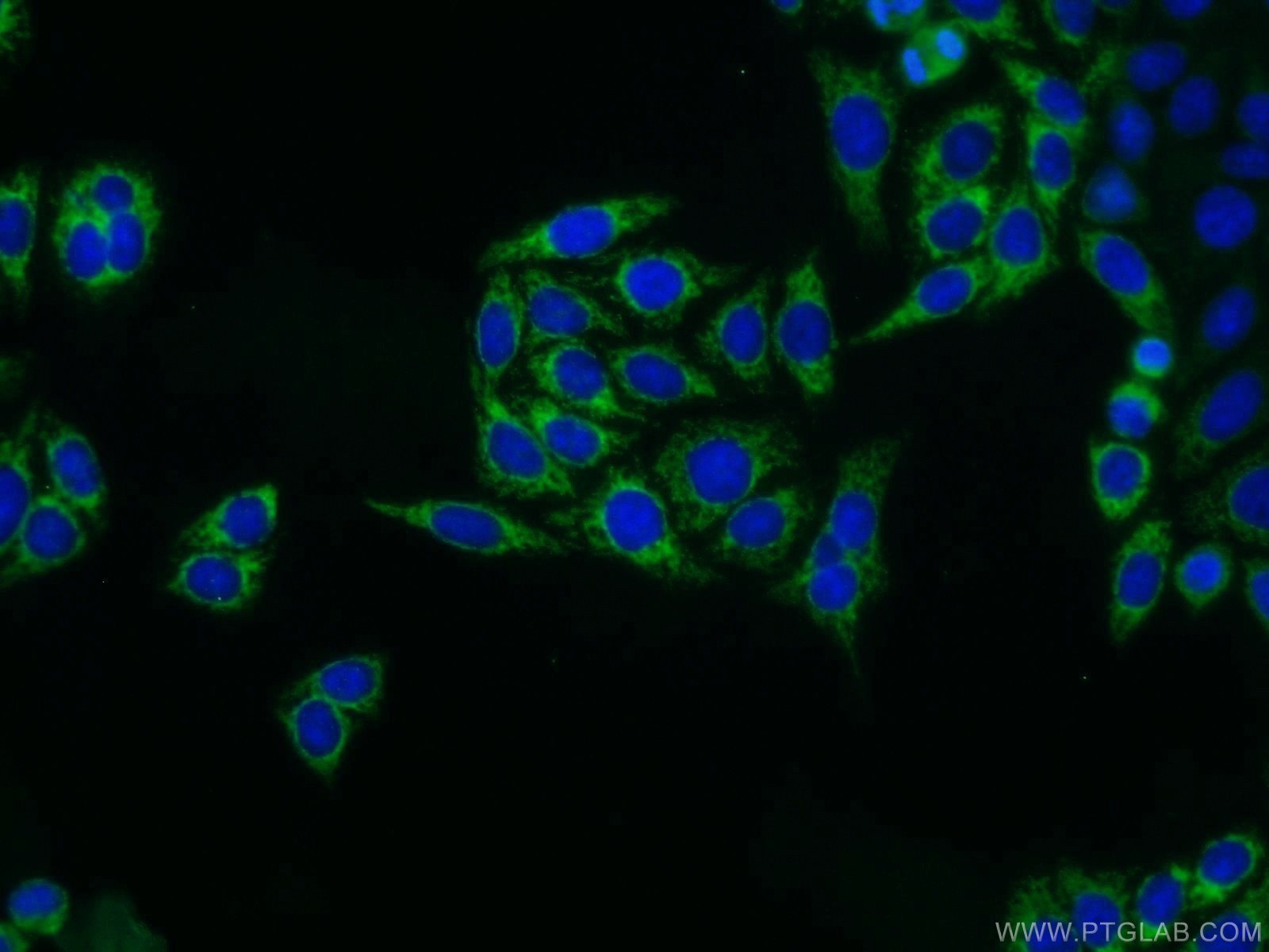 SDHA Polyclonal antibody