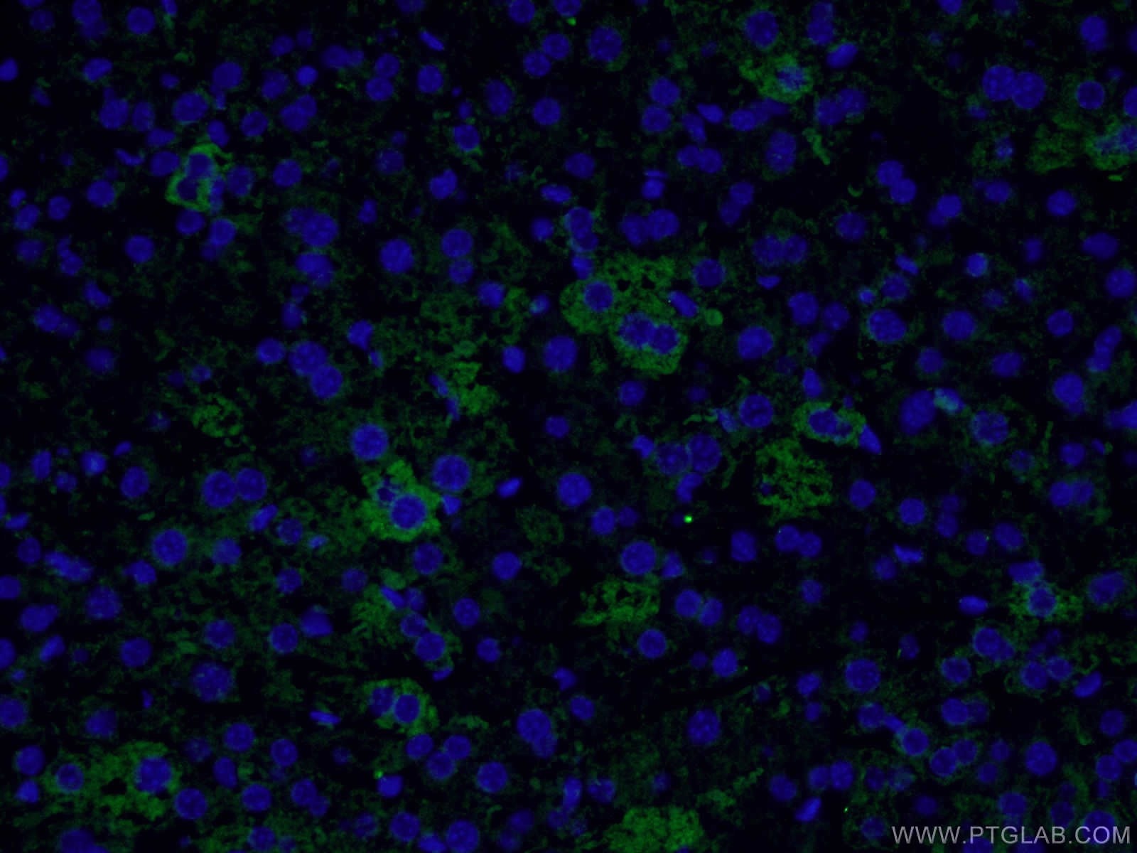 Immunofluorescence (IF) / fluorescent staining of mouse liver tissue using SDHA Polyclonal antibody (14865-1-AP)