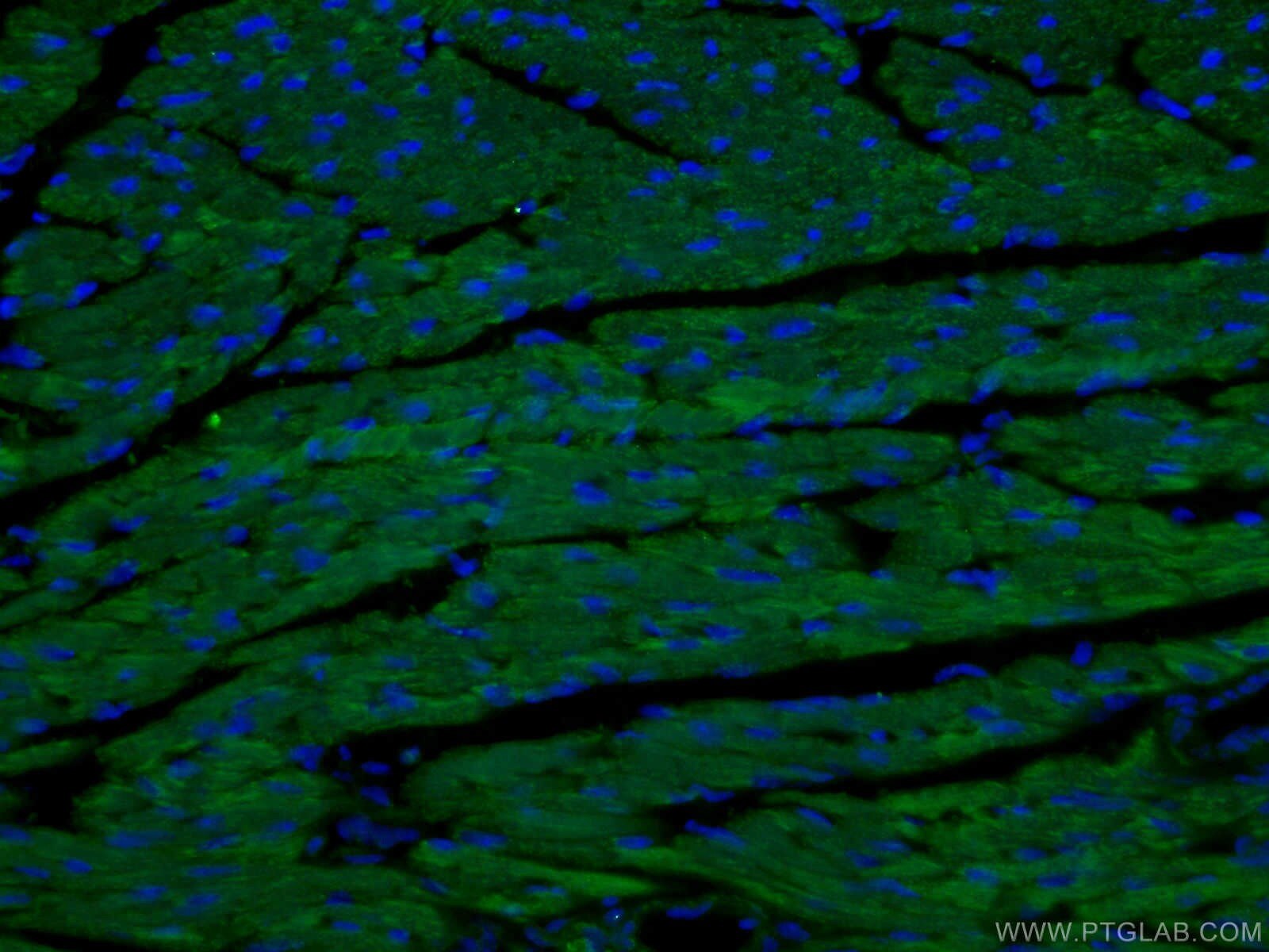 Immunofluorescence (IF) / fluorescent staining of mouse heart tissue using SDHA Polyclonal antibody (14865-1-AP)