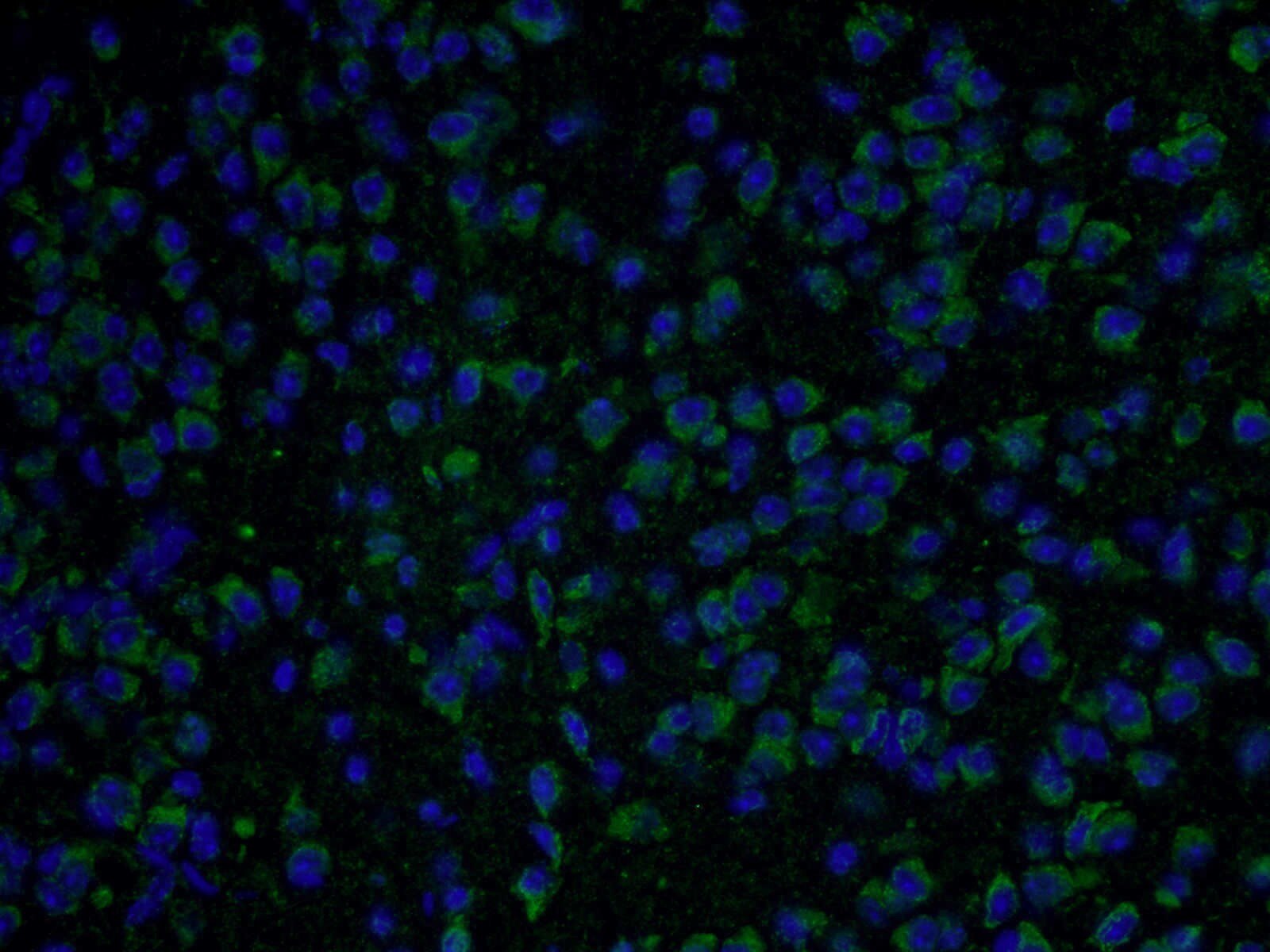 Immunofluorescence (IF) / fluorescent staining of mouse brain tissue using SDHA Polyclonal antibody (14865-1-AP)
