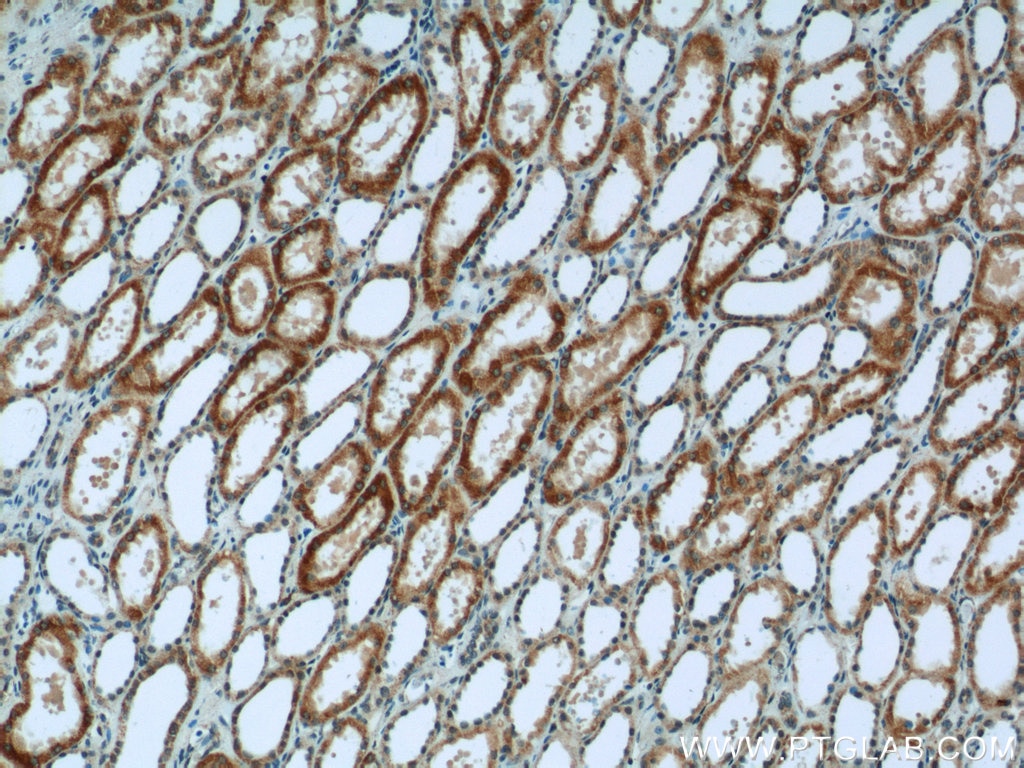 Immunohistochemistry (IHC) staining of human kidney tissue using SDHA Polyclonal antibody (14865-1-AP)
