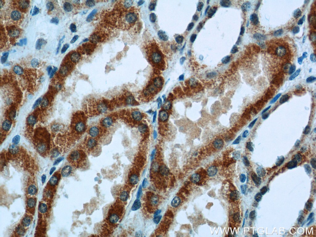 Immunohistochemistry (IHC) staining of human kidney tissue using SDHA Polyclonal antibody (14865-1-AP)