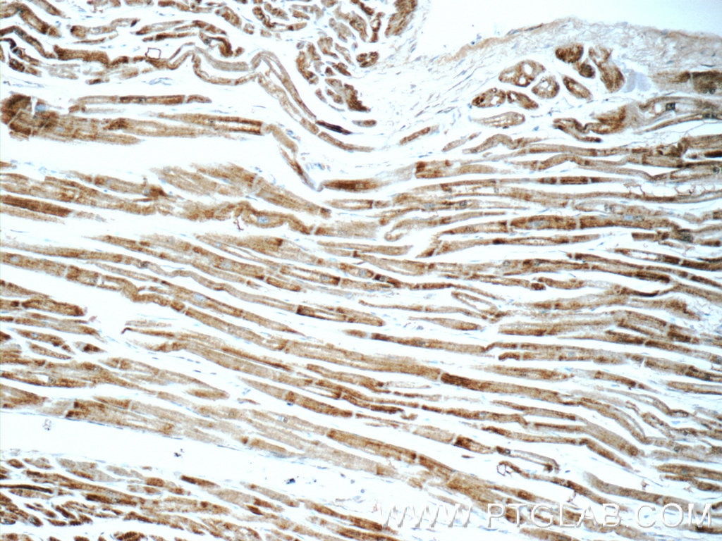 Immunohistochemistry (IHC) staining of human heart tissue using SDHA Polyclonal antibody (14865-1-AP)