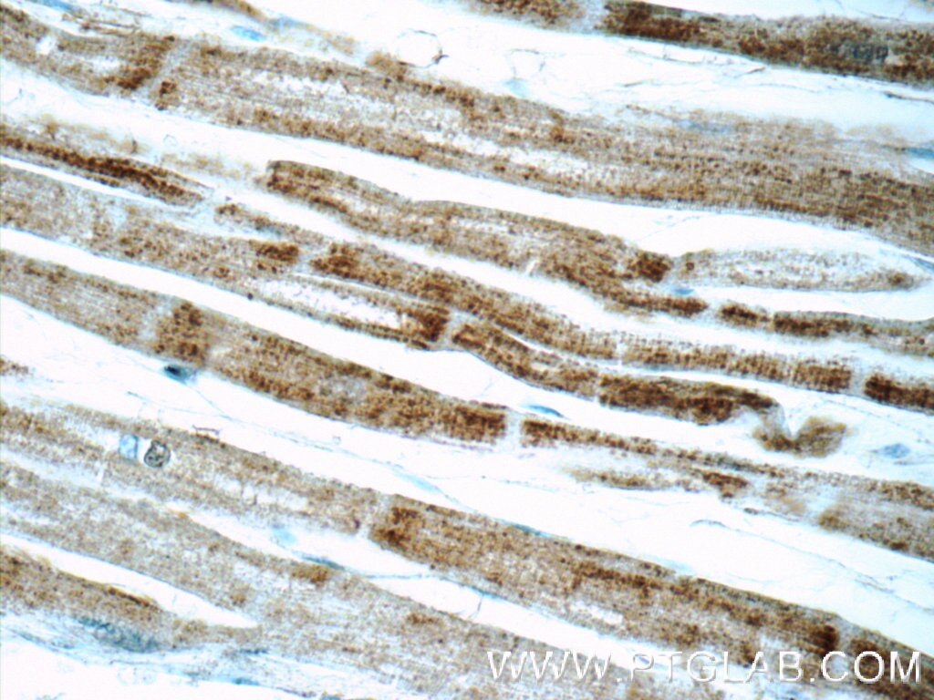 Immunohistochemistry (IHC) staining of human heart tissue using SDHA Polyclonal antibody (14865-1-AP)