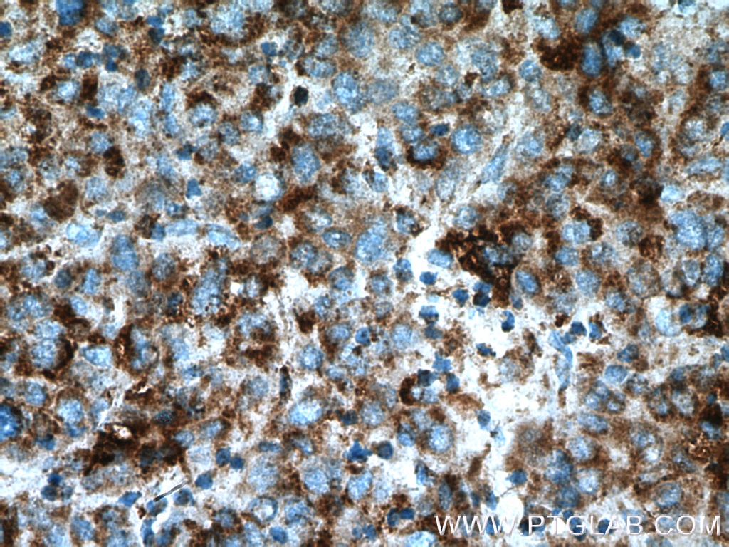 SDHA Polyclonal antibody