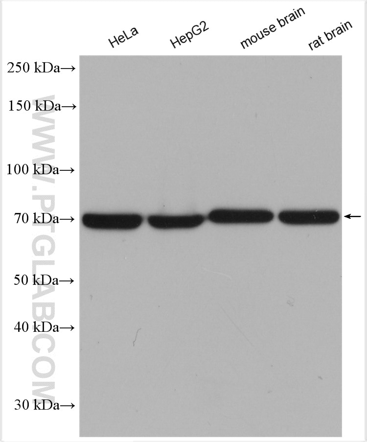 Western Blot (WB) analysis of various lysates using SDHA Polyclonal antibody (14865-1-AP)