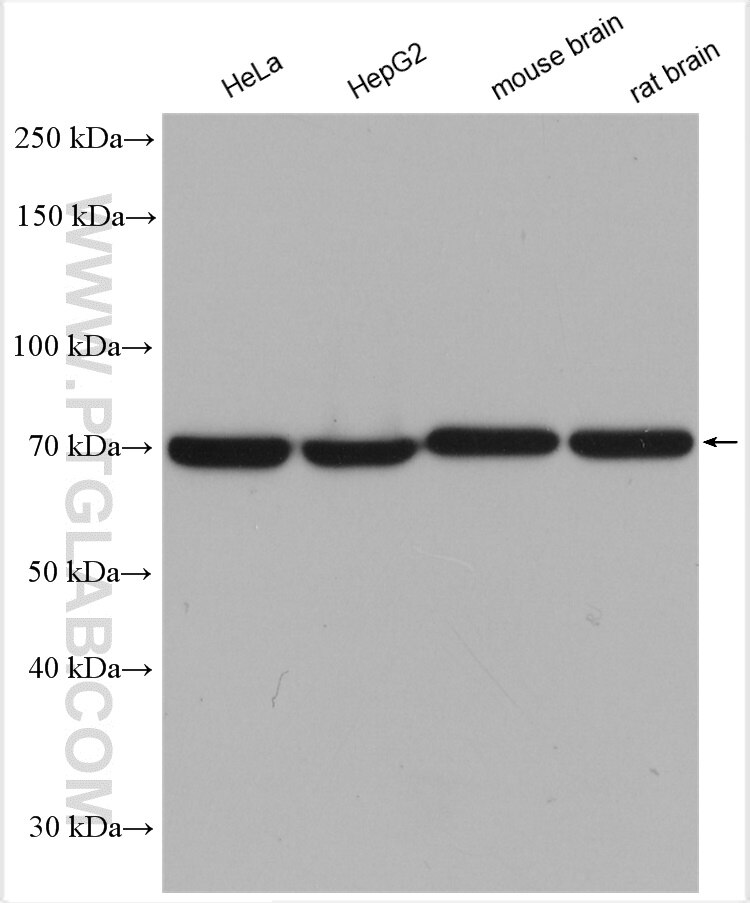 Western Blot (WB) analysis of various lysates using SDHA Polyclonal antibody (14865-1-AP)