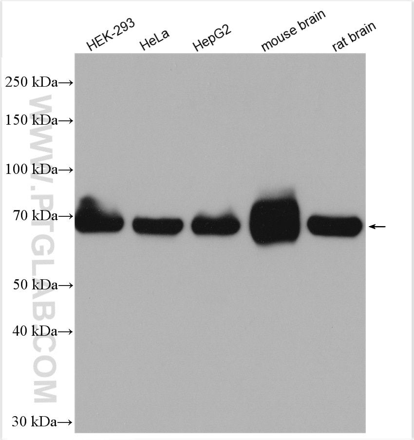Western Blot (WB) analysis of various lysates using SDHA Polyclonal antibody (14865-1-AP)