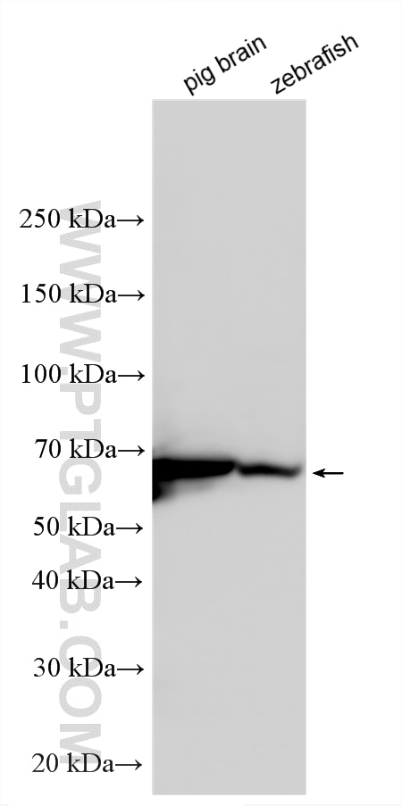 Various lysates were subjected to SDS PAGE followed by western blot with 14865-1-AP (SDHA antibody) at dilution of 1:5000 incubated at room temperature for 1.5 hours. Western Blot (WB) analysis of various lysates using SDHA Polyclonal antibody (14865-1-AP)