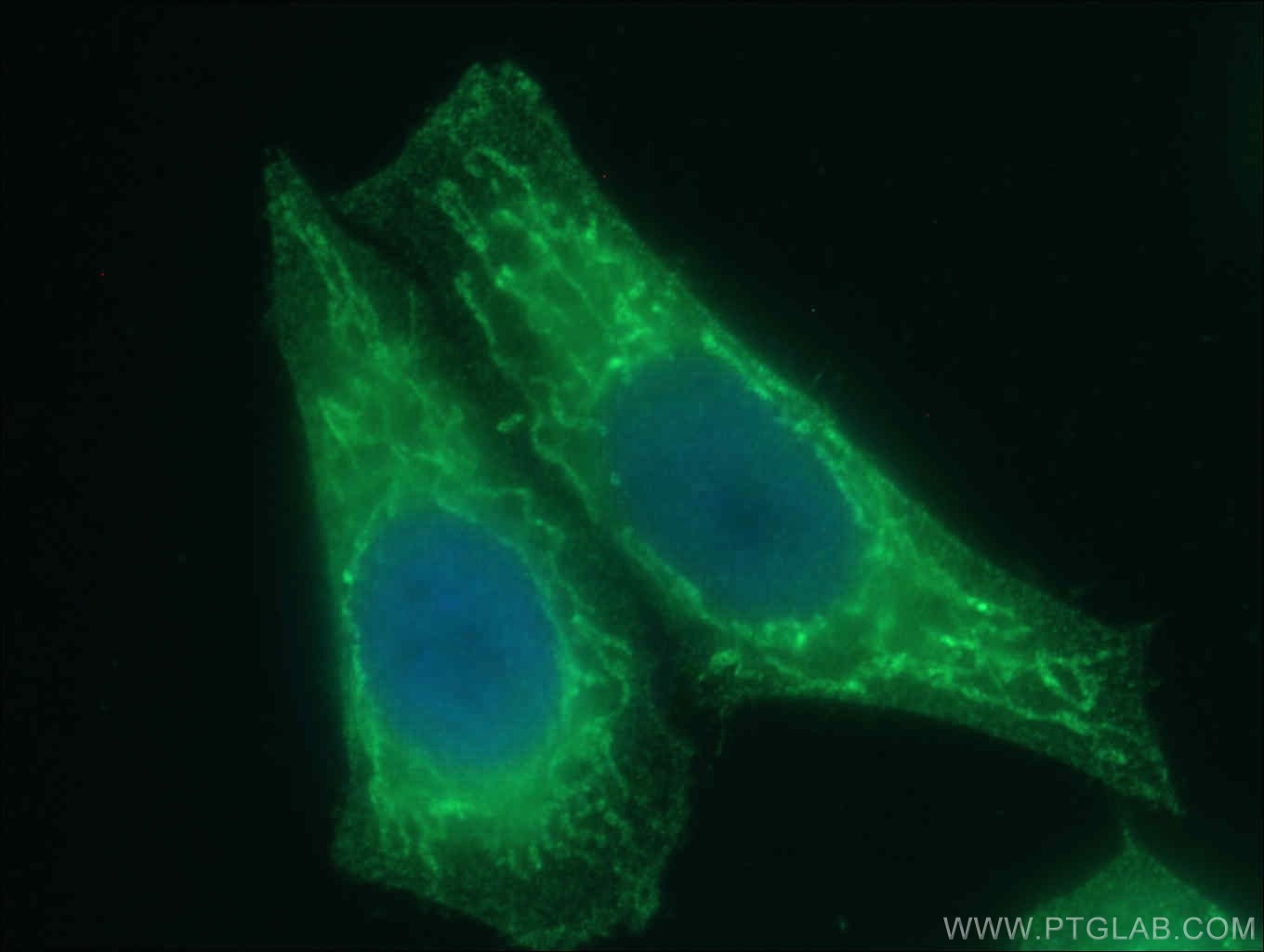 Immunofluorescence (IF) / fluorescent staining of HepG2 cells using SDHA Monoclonal antibody (66588-1-Ig)