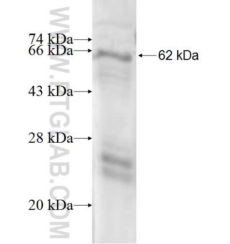 SDHA fusion protein Ag6677 SDS-PAGE