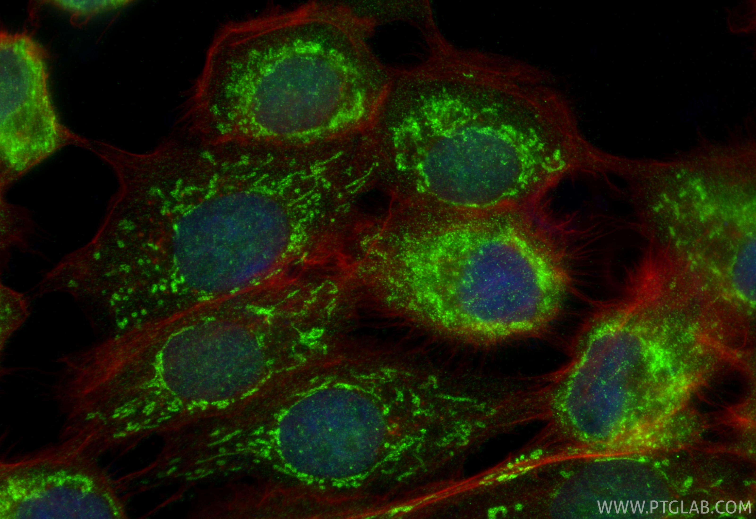 Immunofluorescent analysis of (4% PFA) fixed A431 cells using C6orf57 antibody (30663-1-AP) at dilution of 1:400 and CoraLite®488-Conjugated Goat Anti-Rabbit IgG(H+L) (SA00013-2), CL594-Phalloidin (red). Immunofluorescence (IF) / fluorescent staining of A431 cells using SDHAF4 Polyclonal antibody (30663-1-AP)