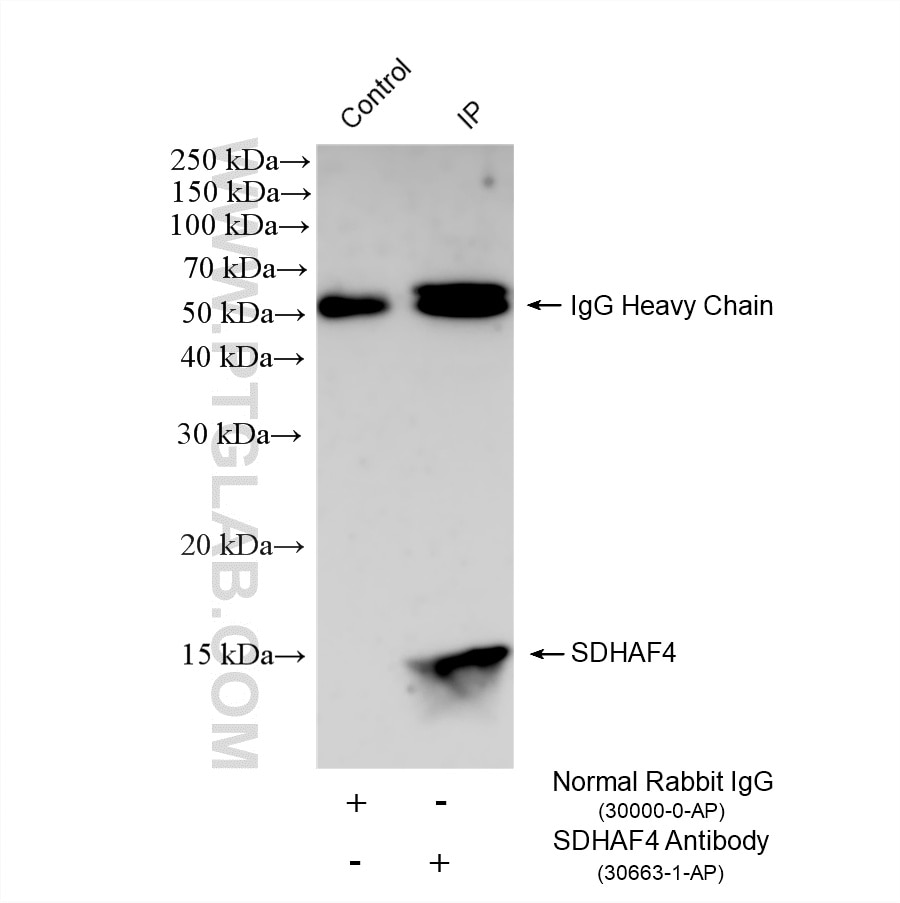 IP result of anti-SDHAF4 (IP:30663-1-AP, 4ug; Detection:30663-1-AP 1:1000) with THP-1 cells lysate 1800 ug. Immunoprecipitation (IP) experiment of THP-1 cells using SDHAF4 Polyclonal antibody (30663-1-AP)