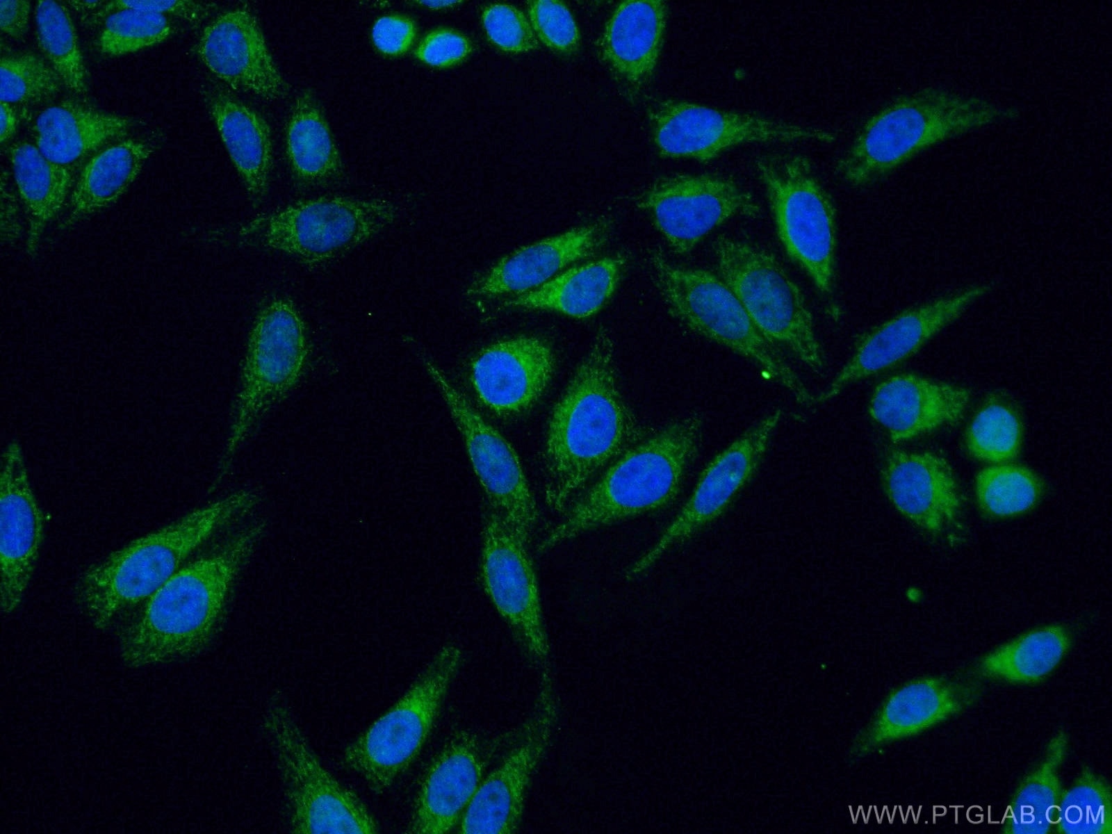 Immunofluorescence (IF) / fluorescent staining of HepG2 cells using SDHB Polyclonal antibody (10620-1-AP)