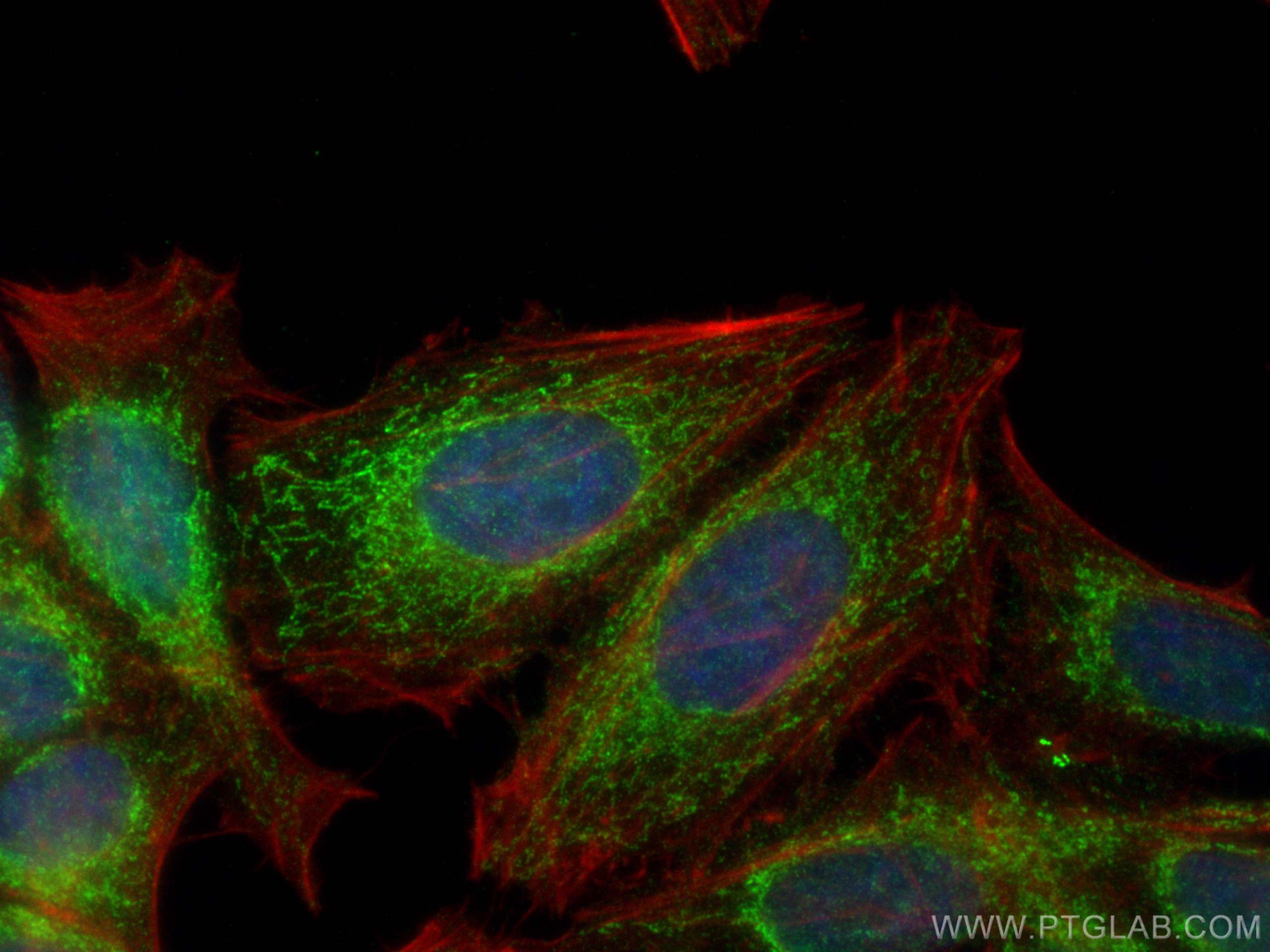 Immunofluorescence (IF) / fluorescent staining of HepG2 cells using human SDHB Polyclonal antibody (10620-1-AP)