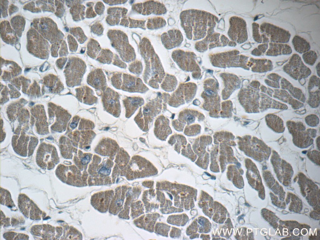 SDHB Polyclonal antibody