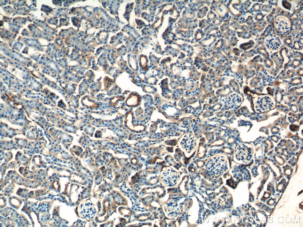 Immunohistochemistry (IHC) staining of mouse kidney tissue using SDHB Polyclonal antibody (10620-1-AP)