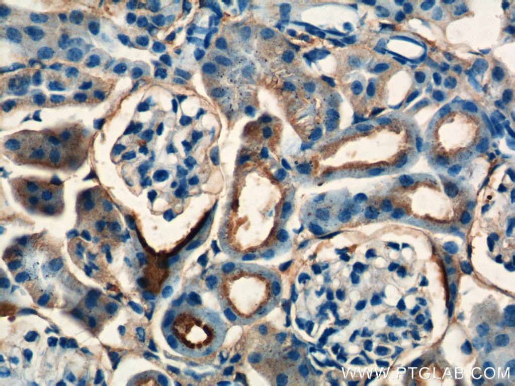 Immunohistochemistry (IHC) staining of mouse kidney tissue using SDHB Polyclonal antibody (10620-1-AP)