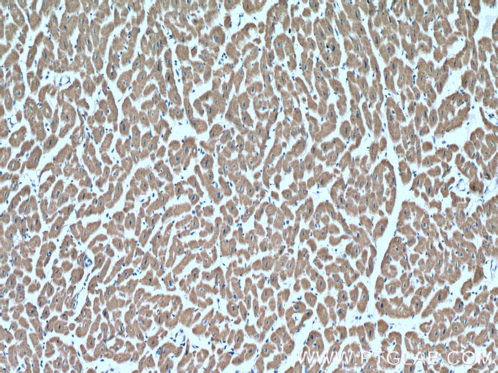 IHC staining of human heart using 10620-1-AP