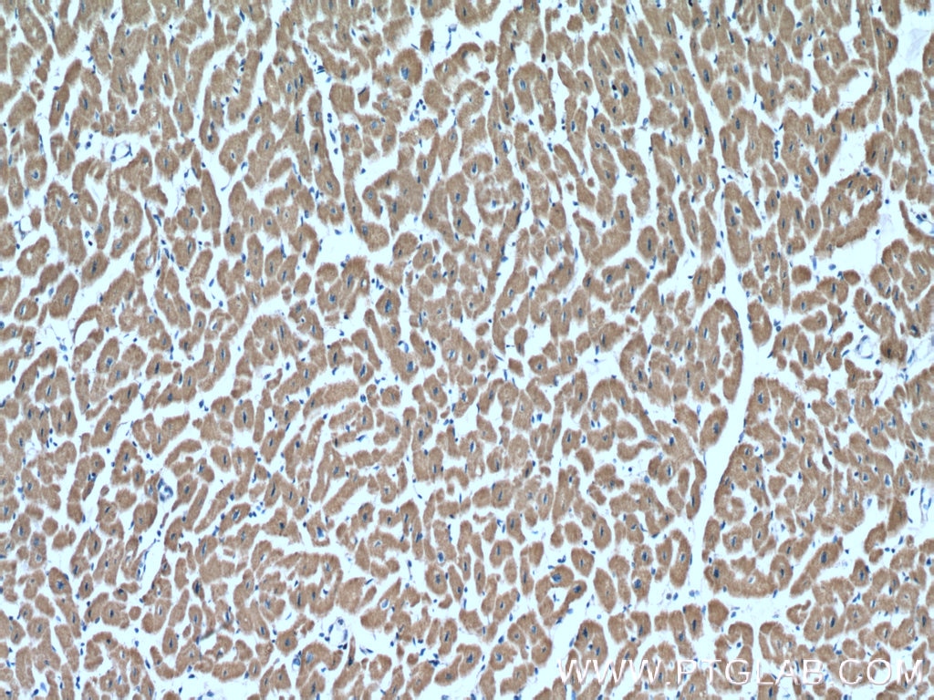 Immunohistochemistry (IHC) staining of human heart tissue using SDHB Polyclonal antibody (10620-1-AP)